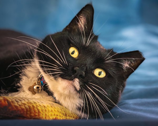 What Are the Technological Advances in Non-Invasive Brain Stimulation Therapies?